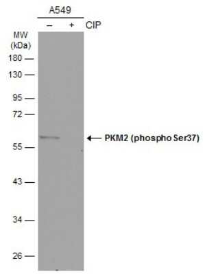 Western Blot: PKM2 [p Ser37] Antibody [NBP3-13307]